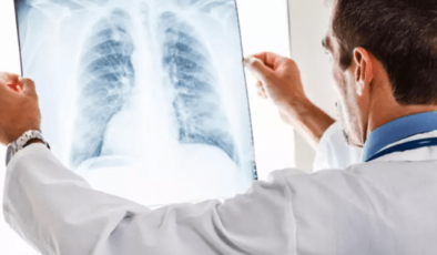 Eski bina enkazlarındaki asbest lifleri akciğer kanserine neden olabilir?