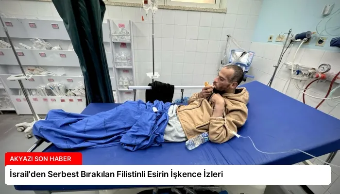 İsrail’den Serbest Bırakılan Filistinli Esirin İşkence İzleri