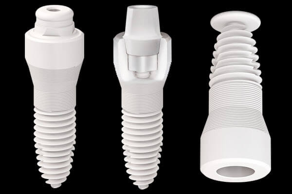 Seramik İmplant Uygulaması: Tedavi Süreci, İyileşme ve Dikkat Edilmesi Gerekenler